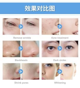 ice blue hydrafacial machine before and after